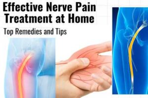 Effective Nerve Pain Treatment at Home